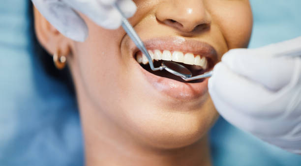 Best Dental Exams and Cleanings  in Summer Set, MO